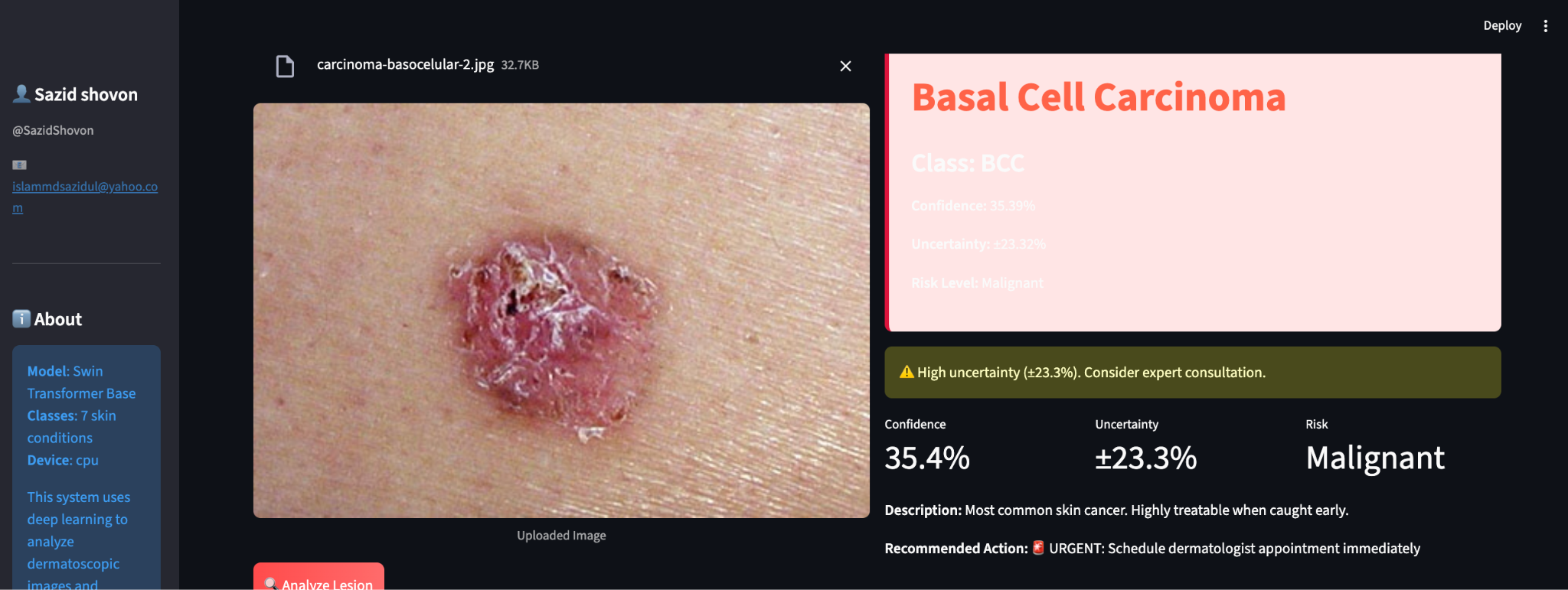 Skin Cancer Detection App